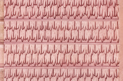 Schloss und Schlossgarten Schwetzingen - Garten - Neue Orangerie - Südseite, Mittelbau, Portal - Blick auf eine tropfsteinartige Bemalung (Gesamter Bau: Länge ca. 171 Meter, Breite ca. 10-12 Meter; Bauzeit: 1761-1762; Architekt: Nicolas de Pigage; umfangreiche Instandsetzung: 1994-1999) (aufgenommen im April 2023, am frühen Nachmittag) Schloss und Schlossgarten Schwetzingen - Garten - Neue Orangerie - Südseite, Mittelbau, Portal - Blick auf eine tropfsteinartige Bemalung (Gesamter Bau: Länge ca. 171 Meter, Breite ca. 10-12 Meter; Bauzeit: 1761-1762; Architekt: Nicolas de Pigage; umfangreiche Instandsetzung: 1994-1999) (aufgenommen im April 2023, am frühen Nachmittag)